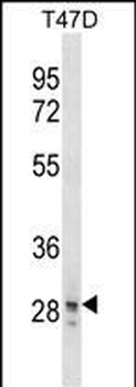 SNAI3 Antibody (N-term)