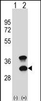 CD79B Antibody (Center)