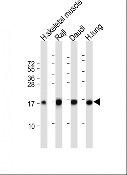TSC22D3 Antibody (Center)