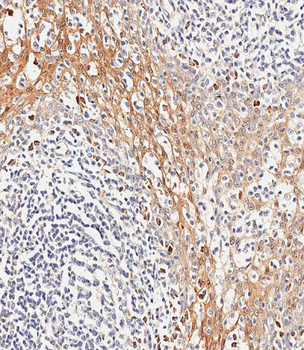 TSC22D3 Antibody (Center)
