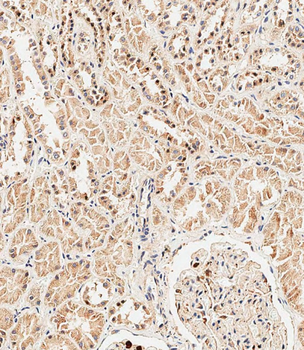 TSC22D3 Antibody (Center)