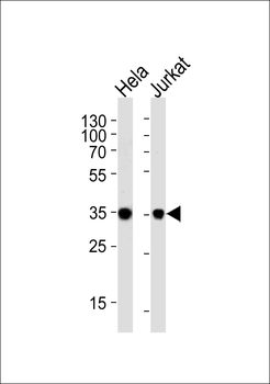 FRG1 Antibody (C-term)