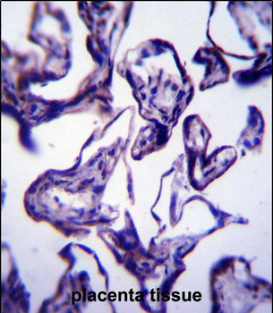 LEP Antibody (N-term)