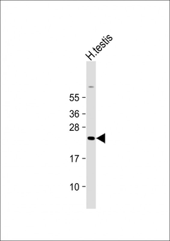H2BFWT Antibody (Center)