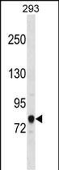 ACSL3 Antibody (C-term)