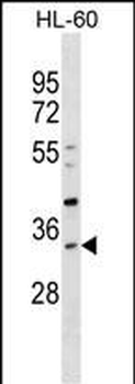 SULT1B1 Antibody (C-term)