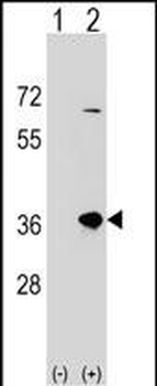 SULT1B1 Antibody (C-term)