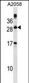PLA2G12A Antibody (Center)