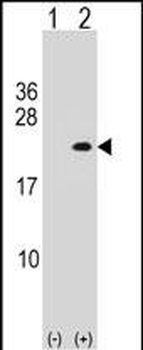 PLA2G12A Antibody (Center)