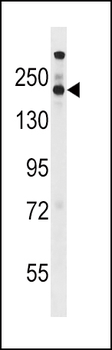 STAG1 Antibody (Center)