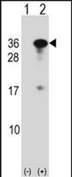 RYBP Antibody (N-term)