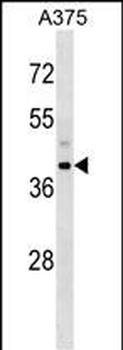 SNUPN Antibody (Center)