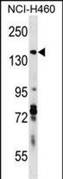 DIAPH3 Antibody (C-term)