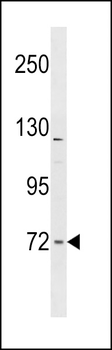 FNBP1L Antibody (Center)