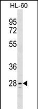 TLCD1 Antibody (C-term)
