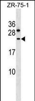 CCDC140 Antibody (N-term)