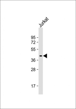 DNMT3L Antibody (C-term)