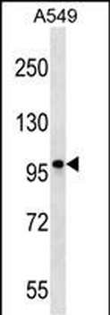 CCDC141 Antibody (N-term)