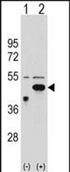 ETNK2 Antibody (N-term)