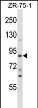 SLITRK4 Antibody (C-term)