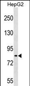 TSC22D2 Antibody (N-term)
