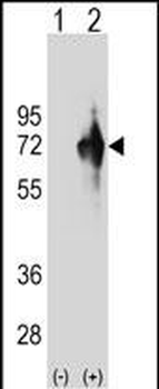 KLHDC4 Antibody (Center)