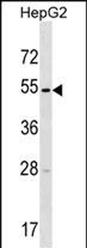 TMPRSS11E Antibody (Center)