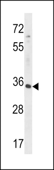 RFNG Antibody (C-term)