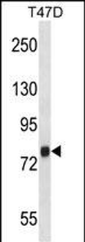 ZC3H14 Antibody (Center)