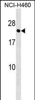 RAB41 Antibody (C-term)