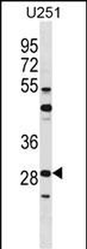 FOSL2 Antibody (C-term)