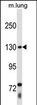 THRAP3 Antibody (C-term)