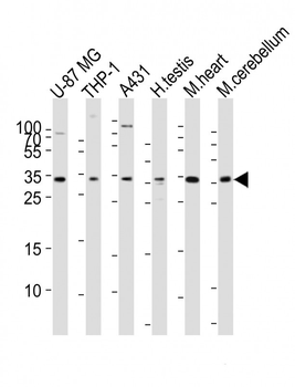 Mouse Mesp1 Antibody (Center)
