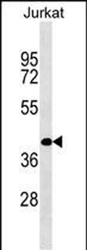 RBMS2 Antibody (N-term)