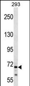 CEP72 Antibody (Center)