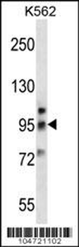 Metabotropic Glutamate Receptor 6 (GPRC1F) Antibody (C-term)