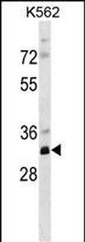 PRPS2 Antibody (Center)