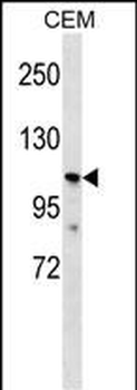 PKD2L1 Antibody (N-term)
