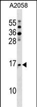 NAT5 Antibody (C-term)
