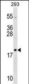 RPL26 Antibody (C-term)