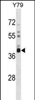 OR52L1 Antibody (C-term)