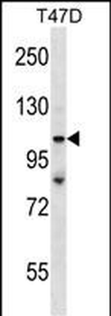 TP53BP2 Antibody (N-term)