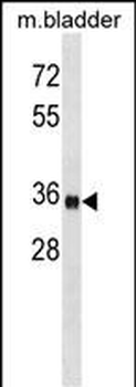 ISL1 Antibody (Center)
