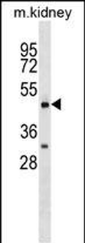 HCRTR2 Antibody (Center)