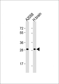 OR4F17 Antibody (N-term)