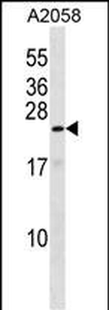 ZN673 Antibody (C-term)