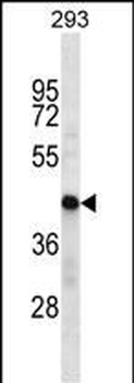 HSDL2 Antibody (Center)