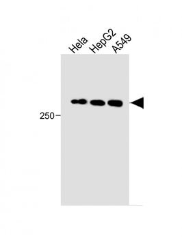 FAM38B Antibody-(C-term)