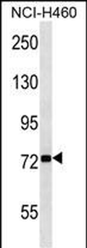 ZNF441 Antibody (N-term)