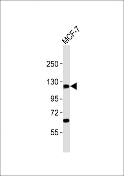 ZNF217 Antibody (N-term)